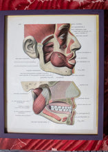 Load image into Gallery viewer, Vintage Medical Book Framed Pages
